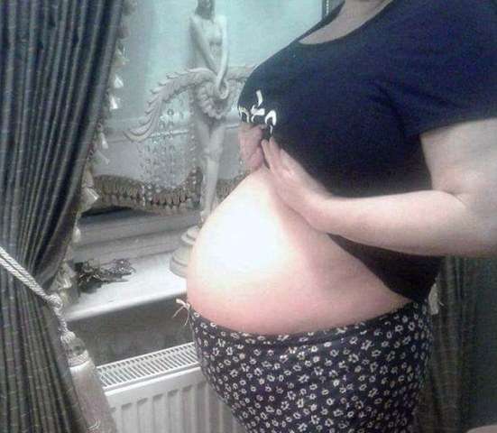 Nëna që dukej sikur të ishte shtatzënë në fakt kishte tumor (FOTO)