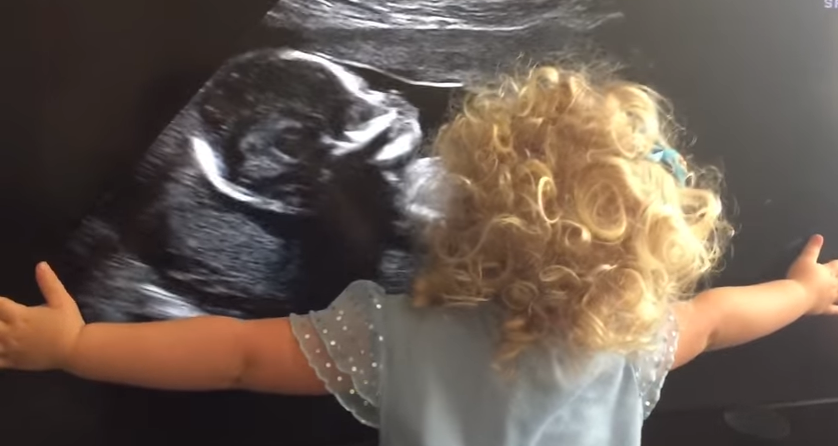 Reagimi i vogëlushes kur sheh motrën në ultrazë (VIDEO)