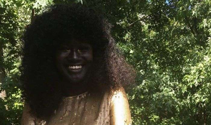 Modelja me ngjyrën e veçantë të lëkurës