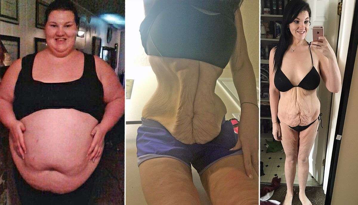 Dikur hante 11,000 kalori në ditë, tani humbet 107 kg