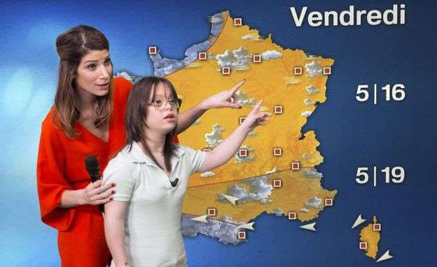 Vajza me sindromën Down prezenton motin në Francë