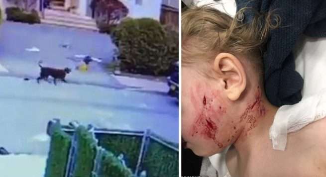 E dhimbshme: Pit-bull tenton ta shqyej trevjeçarin (VIDEO)