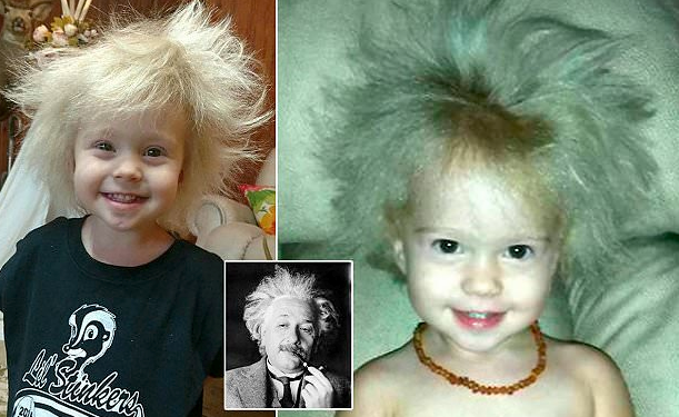 Dyvjeçarja me flokët e çuditshme si Albert Einstein!