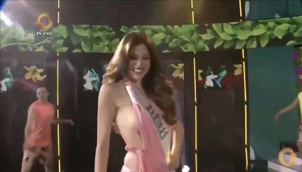 I del gjoksi papritur, modelja vazhdon të ecë sikur s’ka ndodhur asgjë (VIDEO)