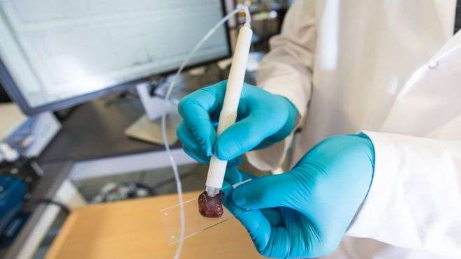 Lapsi që identifikon indet kancerogjene për dhjetë sekonda
