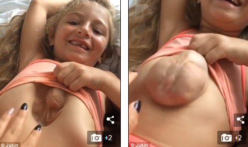 Ja sa është rritur vajza me zemrën jashtë trupit të saj (VIDEO)