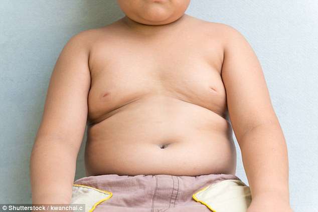 Mos turpëroni fëmijët obezë