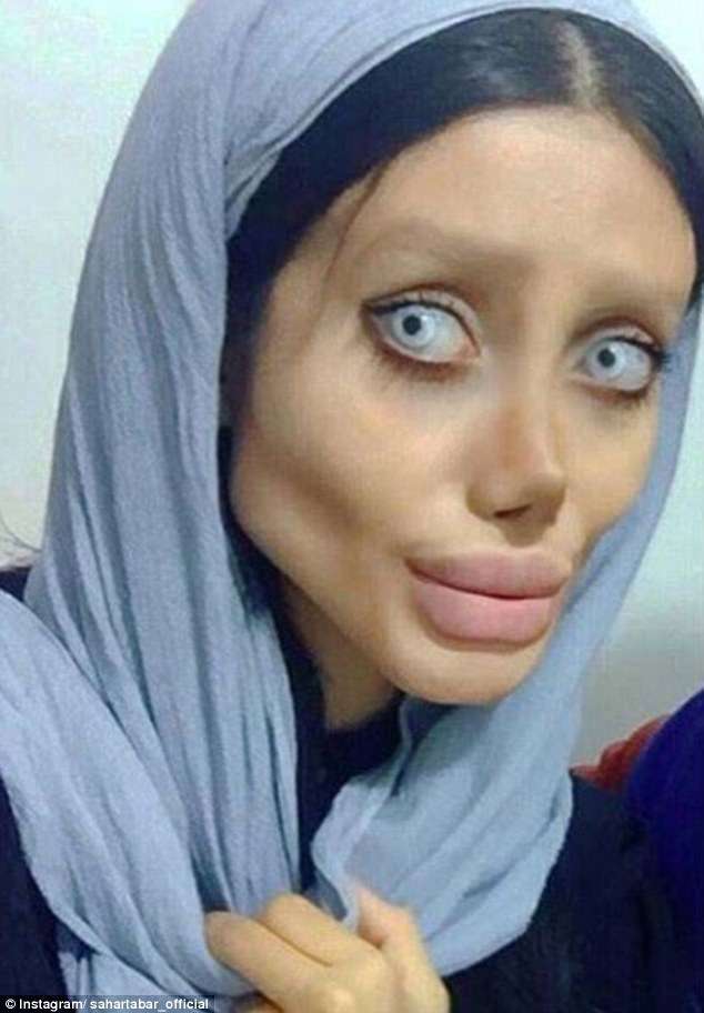 50 ndërhyrje që të duket si Angelina Jolie?! (FOTO)