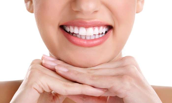 Harrojeni dentistin, zbardhni dhëmbët në mënyrë natyrale