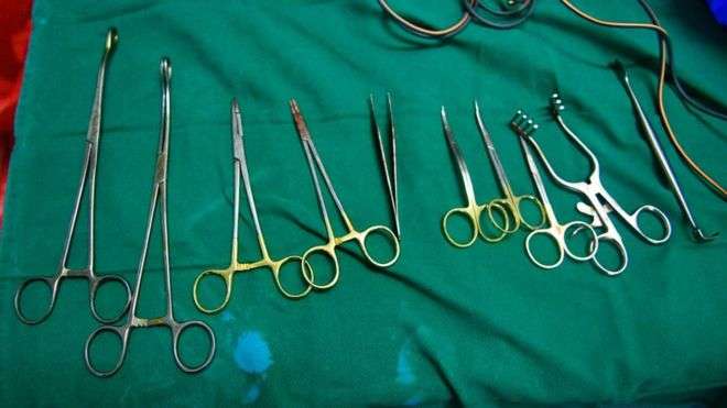 Gruaja japoneze padit qeverinë për sterilizim të detyruar