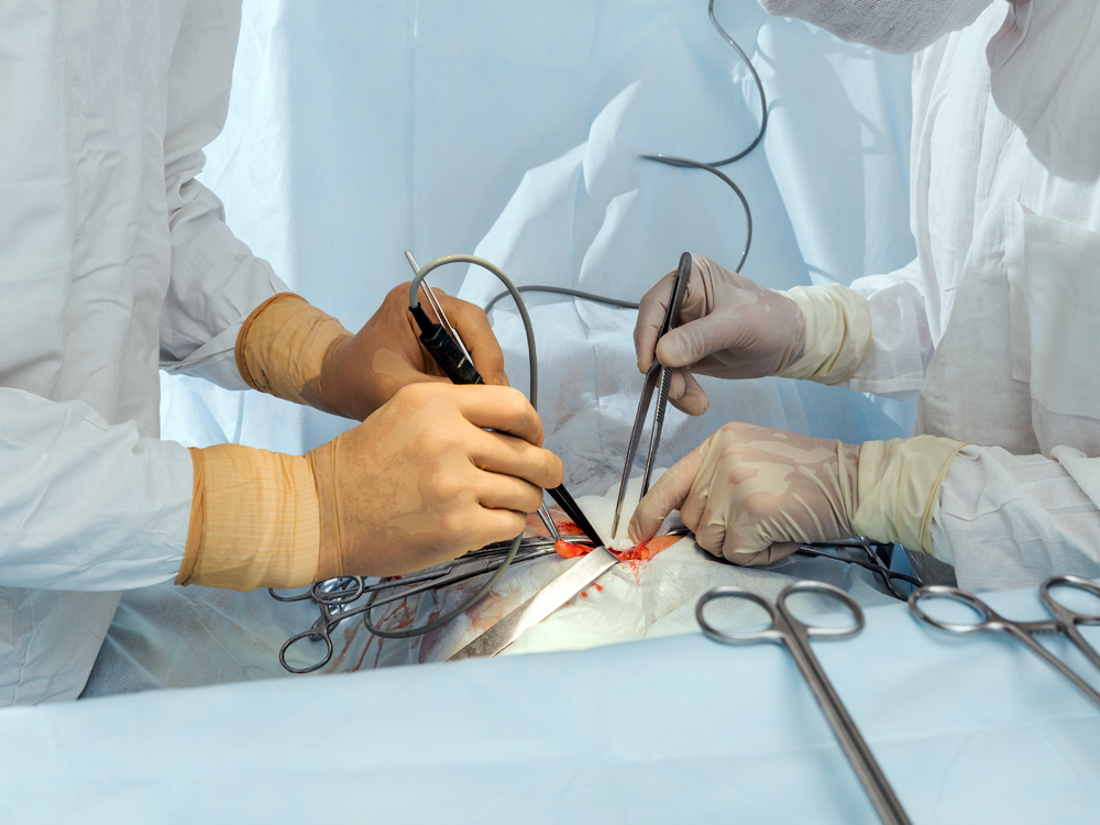 Doktorët francezë bëjnë transplantim të fytyrës për herë të dytë te i njëjti person