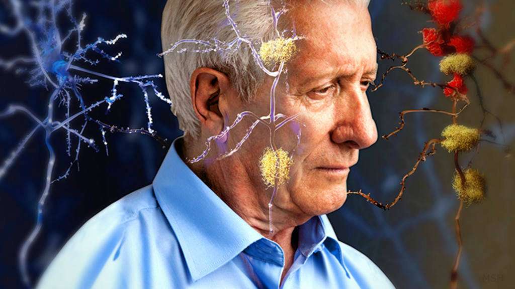 Alzheimeri mund të ketë shërim