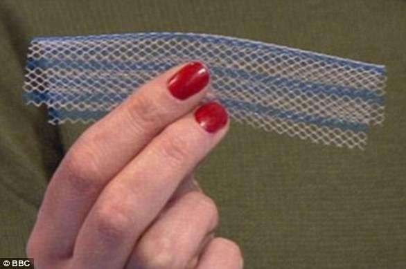 Implantet vaginale po bëjnë gratë të ndjejnë dhembje