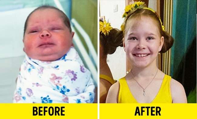 Pas adoptimit, kështu ka ndërruar jeta e këtyre fëmijëve