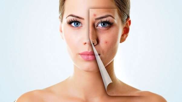 Produktet e bukurisë që dermatologët i kanë futur në listën e tyre të zezë