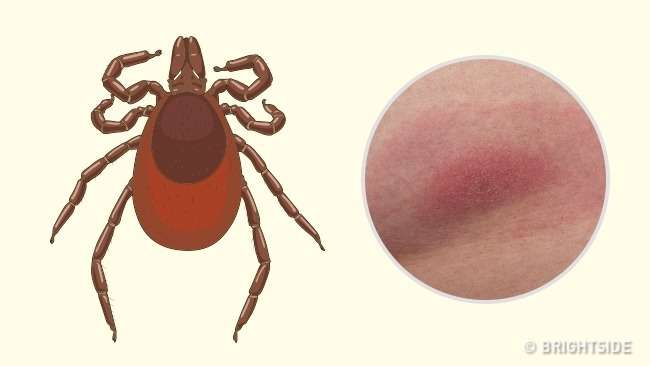 Pickimet e insekteve që duhet t’i identifikoni