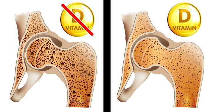 Shenjat se keni nevojë për më shumë vitaminë D