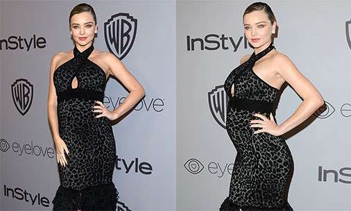 Miranda Kerr fletë për shtatzëninë e saj