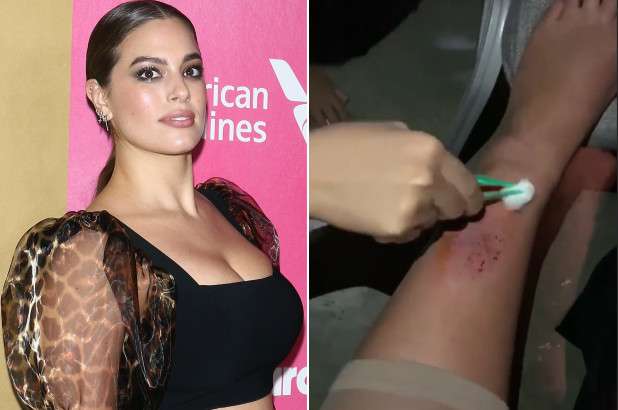 Ashley Graham lëndoi këmbën në prapaskenën e Miss Universe