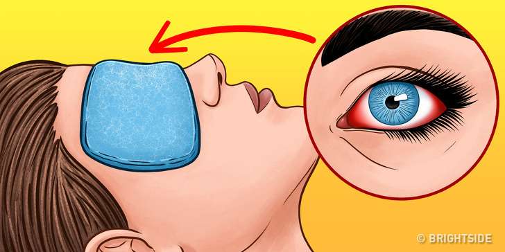 Kështu duhet të kujdeseni për sytë e ndjeshëm
