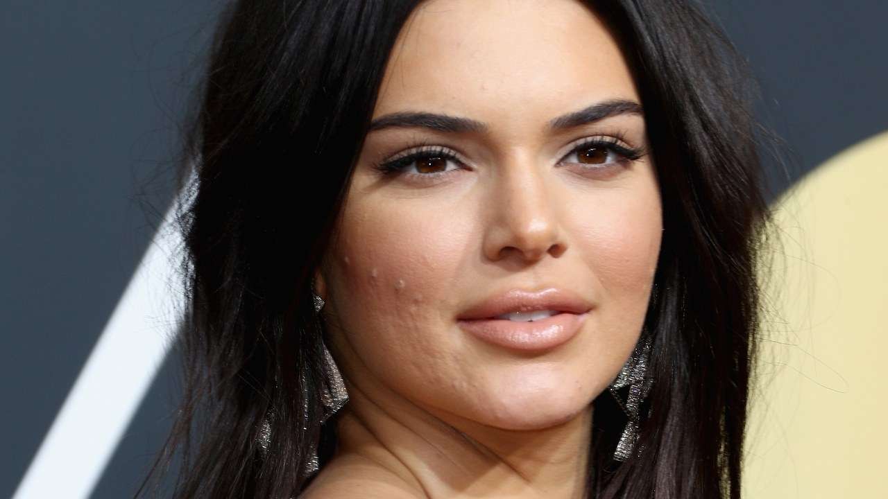 Kendall Jenner thotë se vuan nga aknet