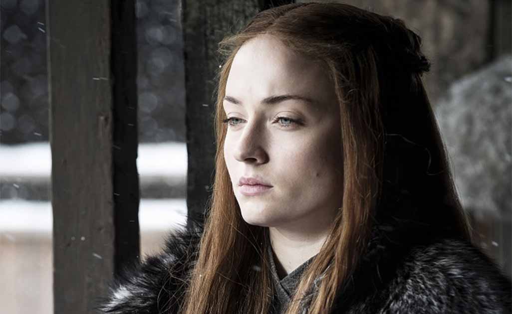 ''Vite pa larë flokët!'', aktorja e ''Game of Thrones'' zbulon sfidat e rolit
