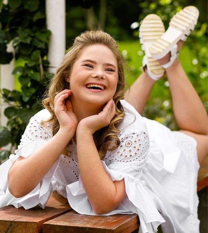 Adoleshentja me Sindromën Down që punoi për pesë agjenci të modës (FOTO)