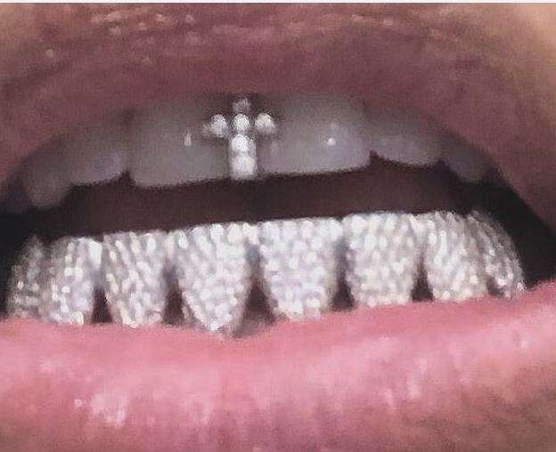 Kim Kardashian vesh dhëmbët me gur diamanti