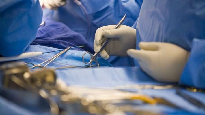 Katër operime specifike në Klinikën e Kirurgjisë Vaskulare në QKUK