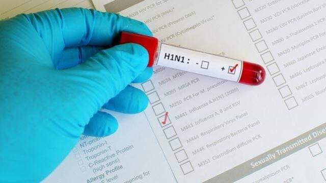 Gripi H1N1, simptomat dhe si të mbrohemi