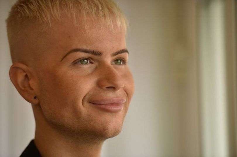 25-vjeçari, fytyra e të cilit është e mbushur me botox (FOTO)