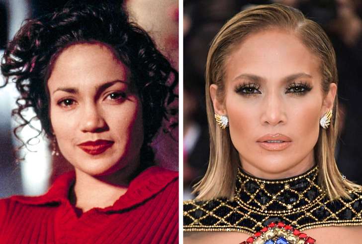 Kështu dukeshin të famshmit para ndërhyrjeve (FOTO)