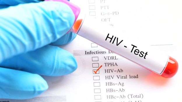 Studim: Transmetimi i HIV tek homoseksualët që përdorin ilaçe është zero
