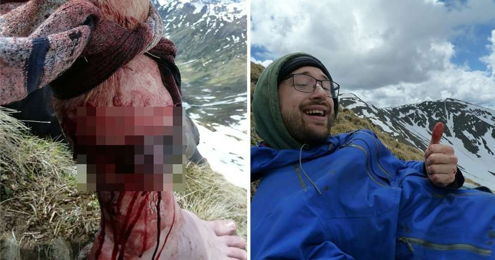 26 vjeçari i shpëton sulmit nga ariu pasi e goditi në fytyrë (FOTO)