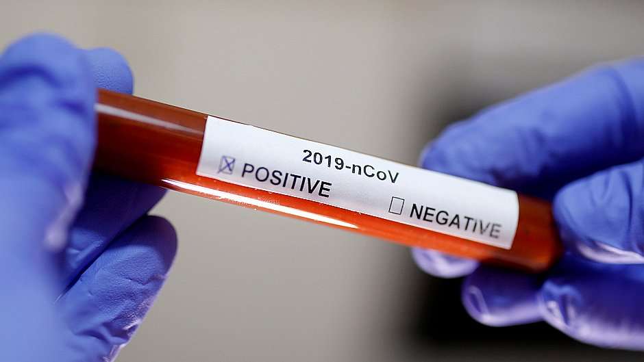 Sot konfirmohen dy raste të reja me Koronavirus