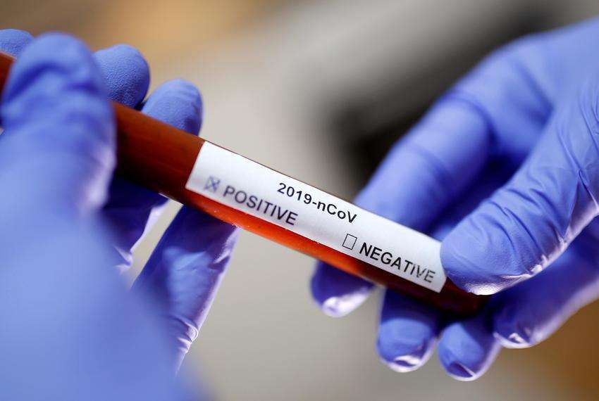 Edhe katër raste me koronavirus, shkon në 28 numri i të prekurve