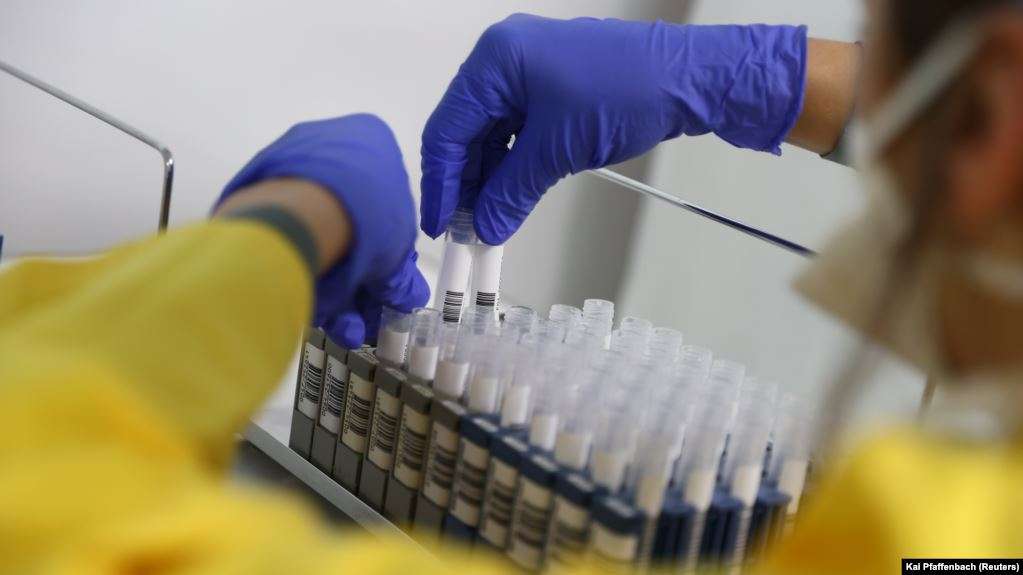 Kosova nuk mund të prodhojë teste për Covid-19, varet nga importi