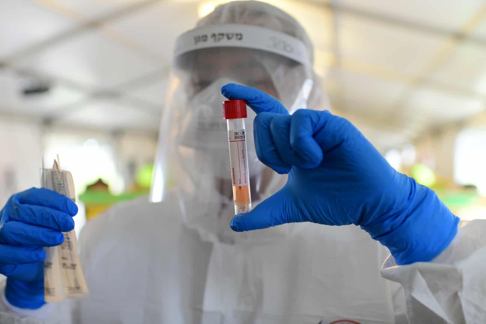 OBSH: Koronavirusi me shumë gjasë ka prejardhje shtazore – s’ka shenjë të manipulimit në laborator