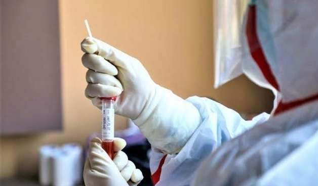 ​3885 raste aktive me koronavirus në Maqedoni, gjithsej 419 të hospitalizuar