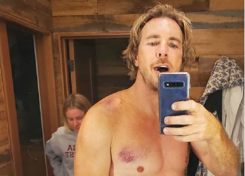 Dax Shepard aksidentohet me motoçikletë, thotë se duhet t'i nënshtrohet një operacioni