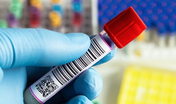 ​Mitrovica me tre laboratorë privatë për teste serologjike, interesim i madh i qytetarëve