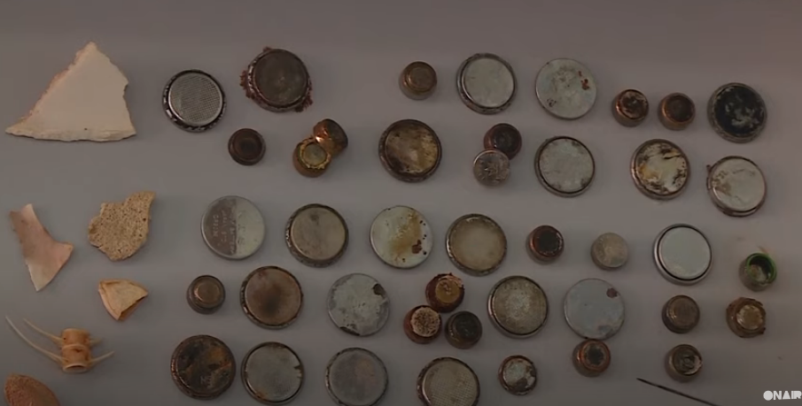 Mjekët mbledhin sende të rrezikshme që i gëlltitën fëmijët (VIDEO)