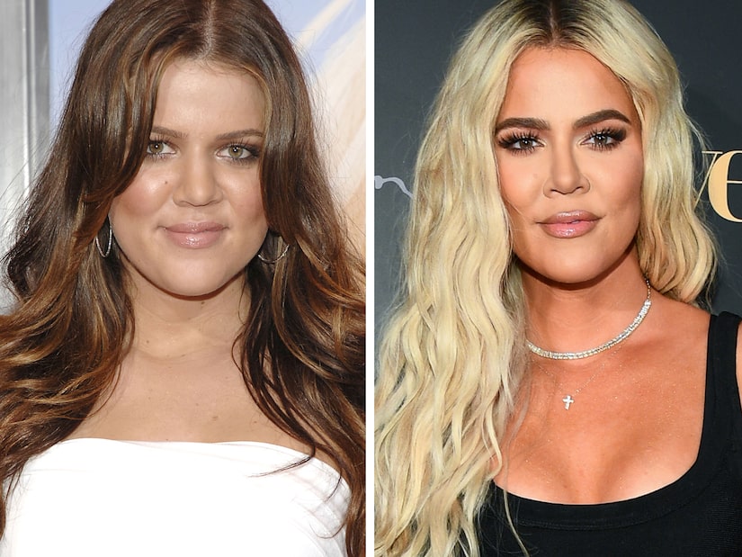 Khloe Kardashian pranon se ka bërë ndërhyrje në hundë