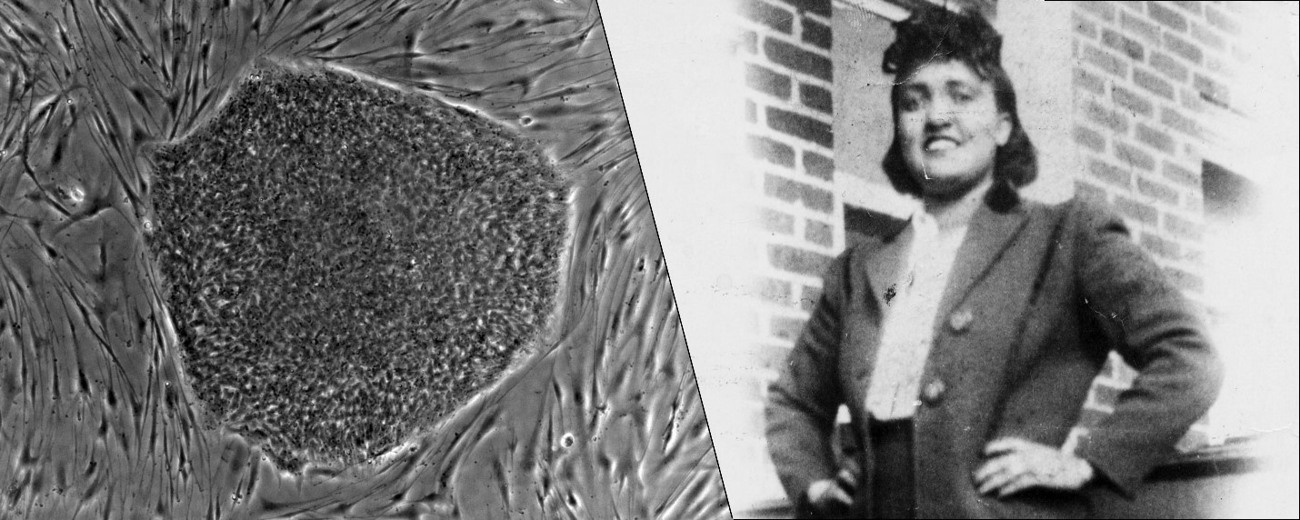 Qelizat 'e pavdekshme' të një gruaje që ndryshuan botën