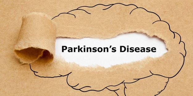 Çka duhet të dini për terapinë kirurgjikale që përdoret për trajtimin e Parkinsonit?