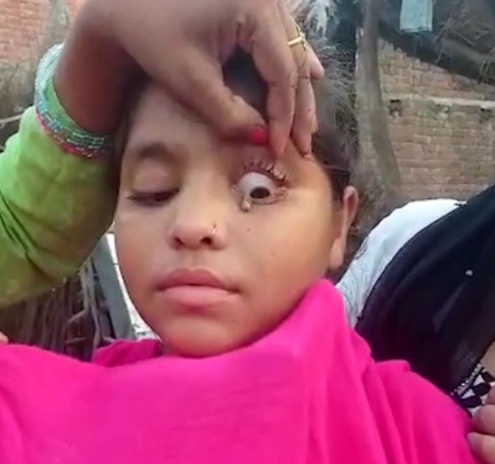 Mjekët tronditen pasi 15 vjeçarja nxjerr gurë në vend të lotit