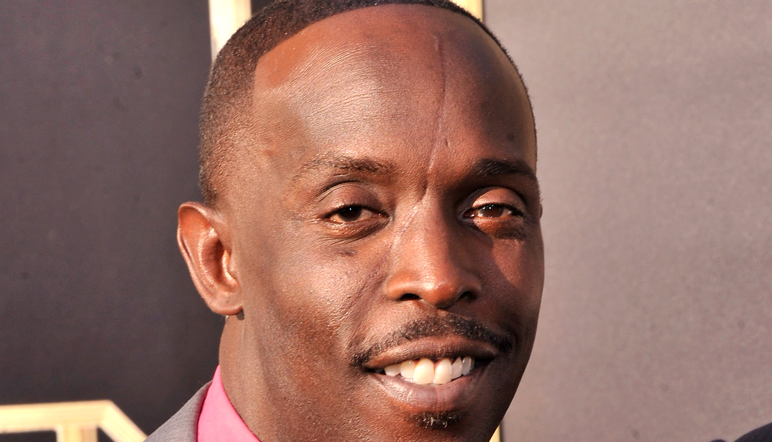 Michael K. Williams dikur shpjegoi se si u bë me shenjë në fytyrë