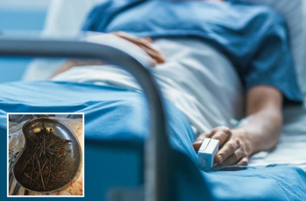 Mjekët në Lituani gjejnë mbi një kilogram gozhda dhe vida në stomakun e pacientit