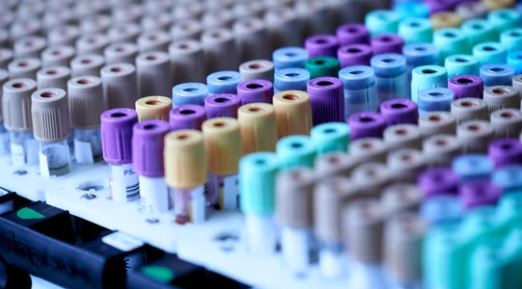 Studim: Biomarkeri i ri i gjakut parashikon diabetin e tipit 2 disa vite përpara diagnozës