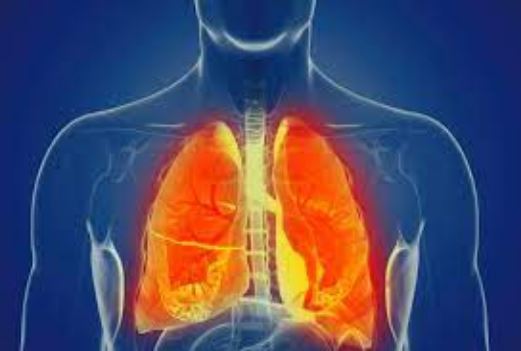 Aktiviteti i rregullt fizik mund të ndikojë në uljen e rrezikut të vdekshmërisë nga pneumonia
